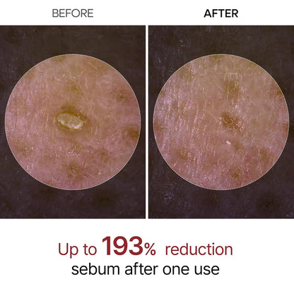 Dr. Melaxin Rice Exfoliating Serum Pore Shrinking Korean Skin Care
